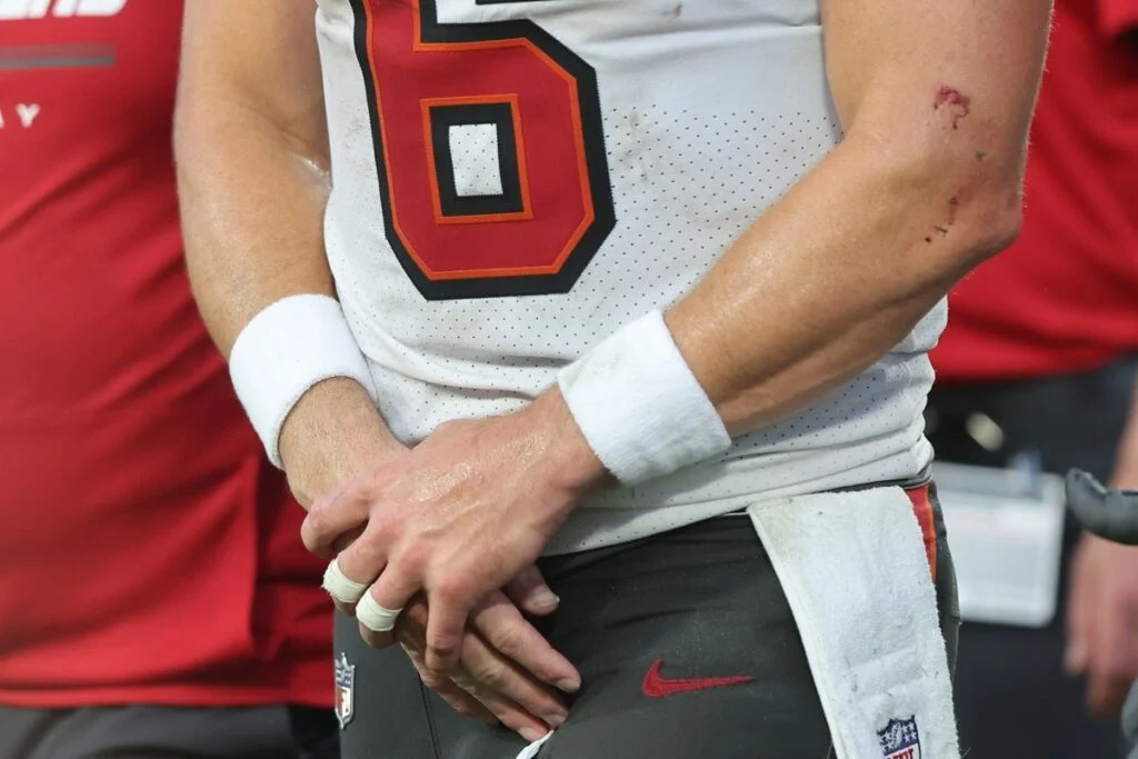 Baker Mayfield Injured In Bucs' Week 3 Loss, Will Miss Time 2 Bucs Qb Baker Mayfield