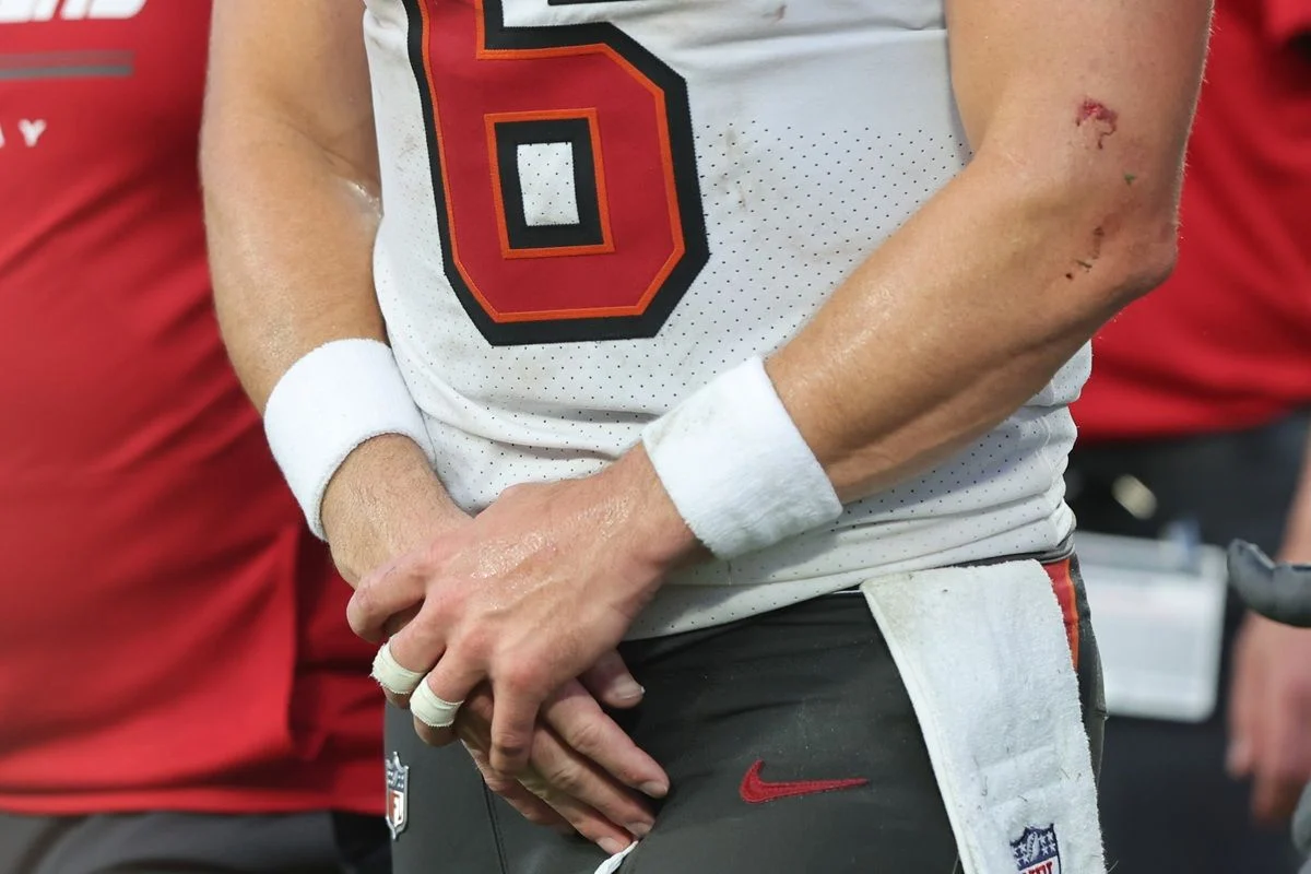 Baker-Mayfield-Injured-Hand-Closeup Bucs Qb Baker Mayfield